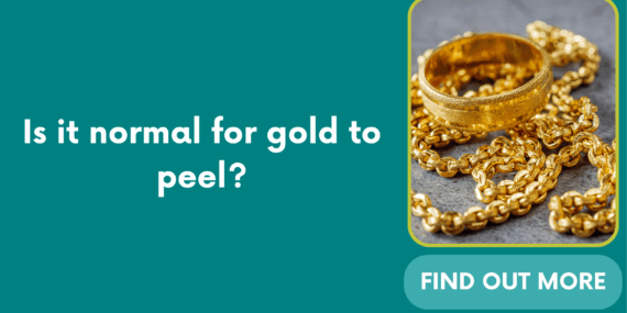 Is it normal for gold to peel?